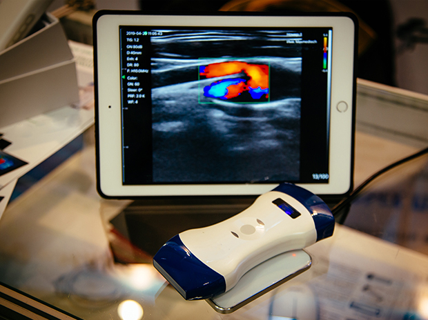 Portable ultrasound systems