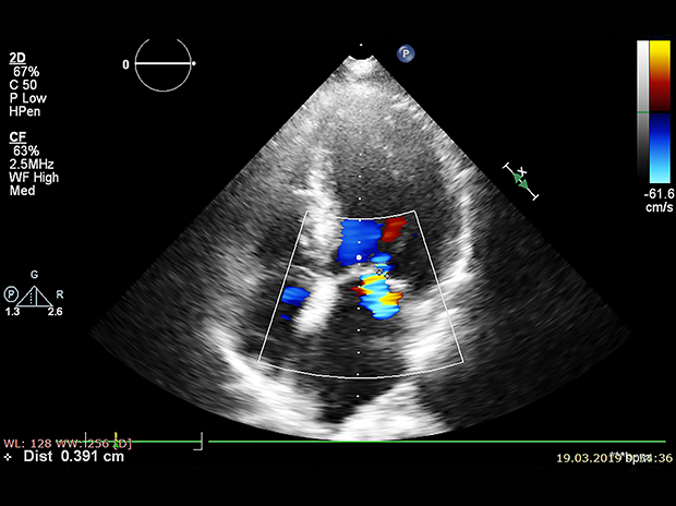 cardiac ultrasounds